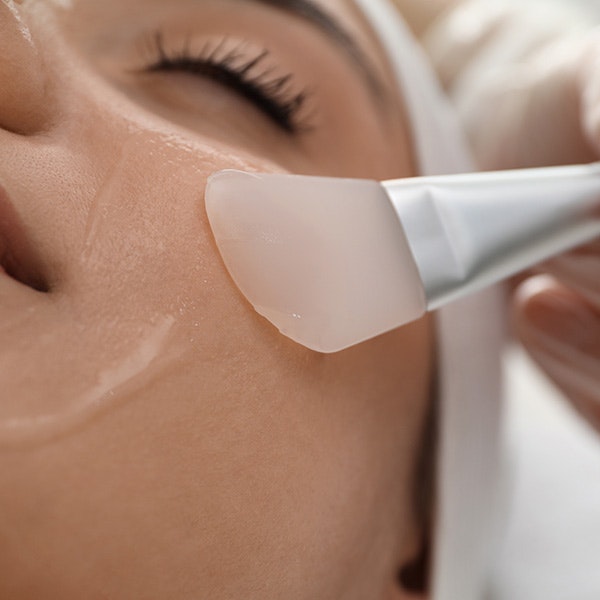 Chemical Peel
