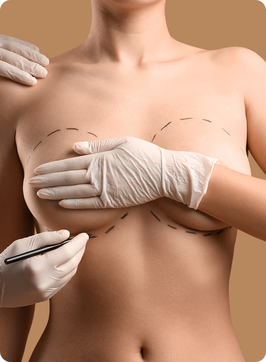 Doctor marking breasts for surgery