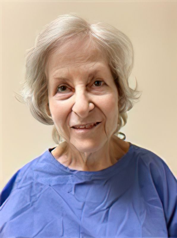 before plastic surgery