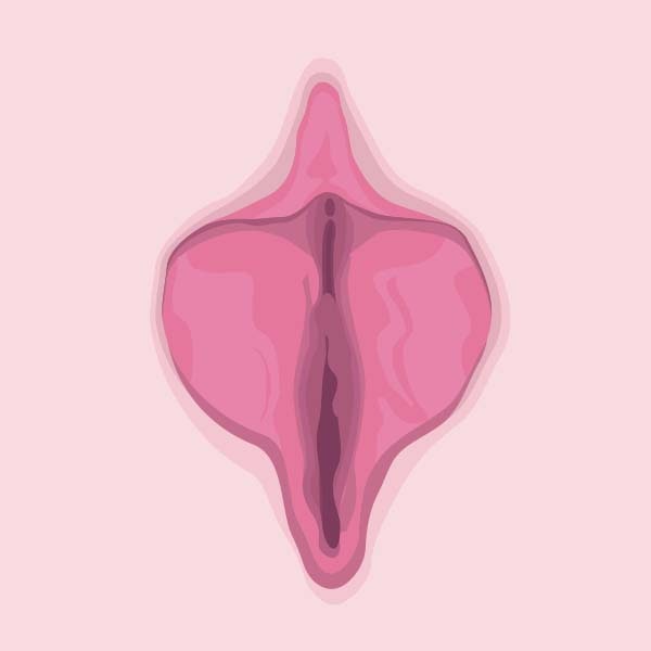 Labia Majora Contouring