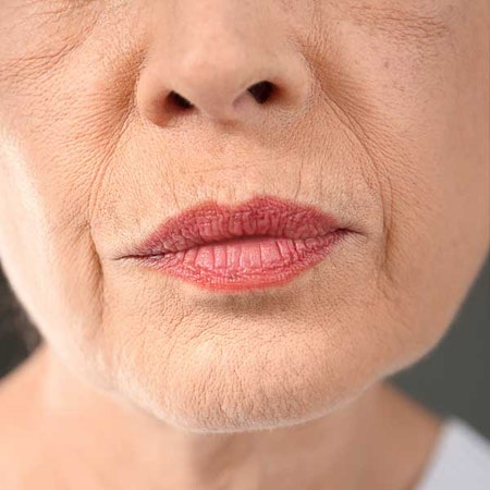 Woman with signs of aging