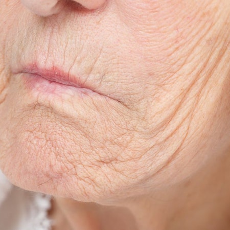 Woman with signs of aging