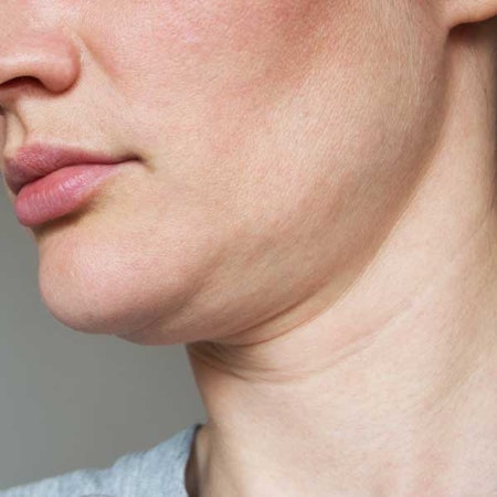 Woman with signs of aging