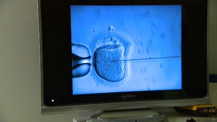 Fertilization procedure
