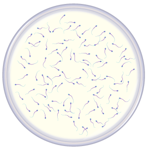Many sperm in petri dish