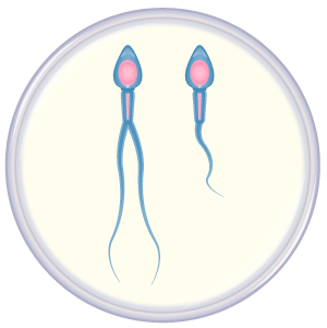 Two sperm in petri dish, one with long flagella and one with short