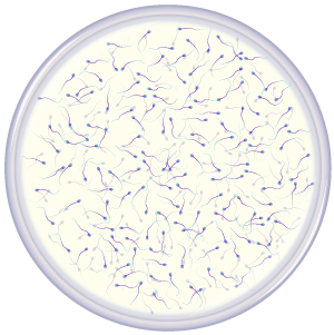 Many sperm in petri dish