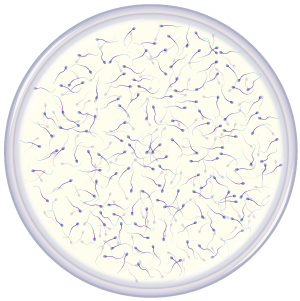 Many sperm in petri dish