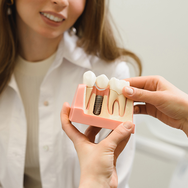 Model of implants and denture