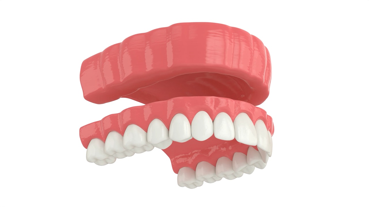 traditional dentures
