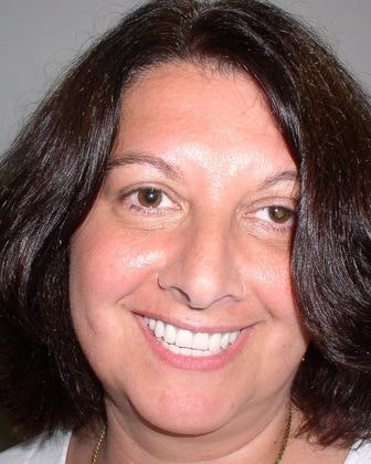 beautiful white, even smile after dental implants