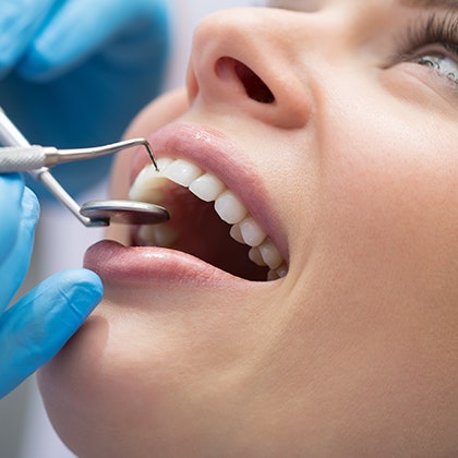 Patient's smile being refined