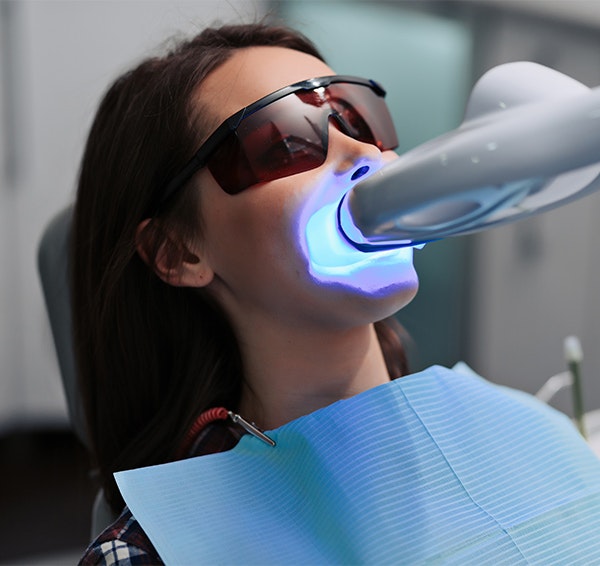 Teeth Whitening Before and After