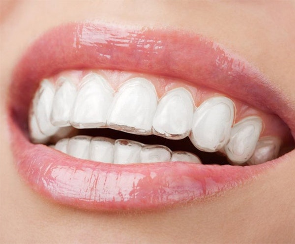 Smiling woman with Invisalign