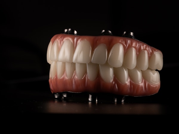 All-on-4 Dental Implant denture