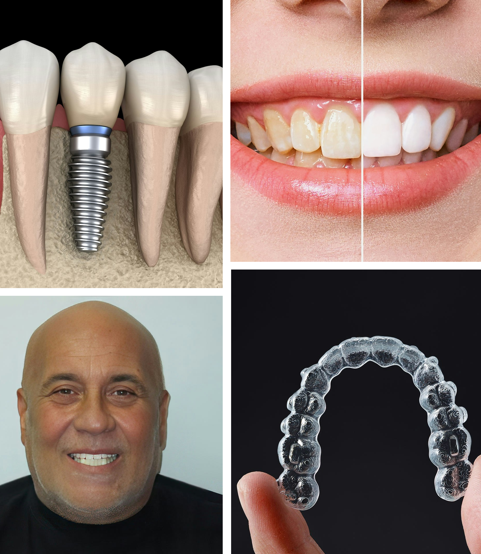 dentist and treatment collage