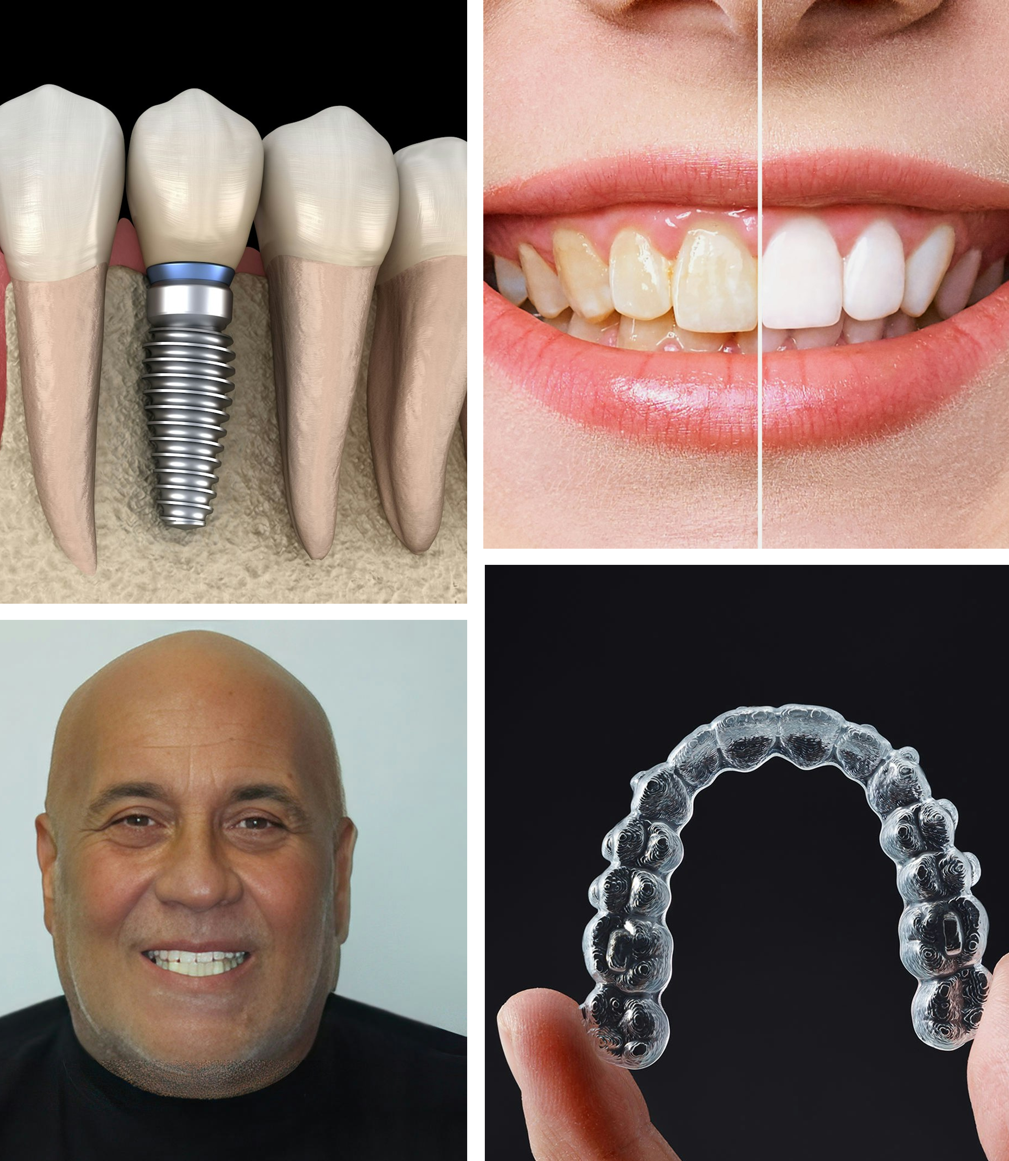 dentist and treatment collage