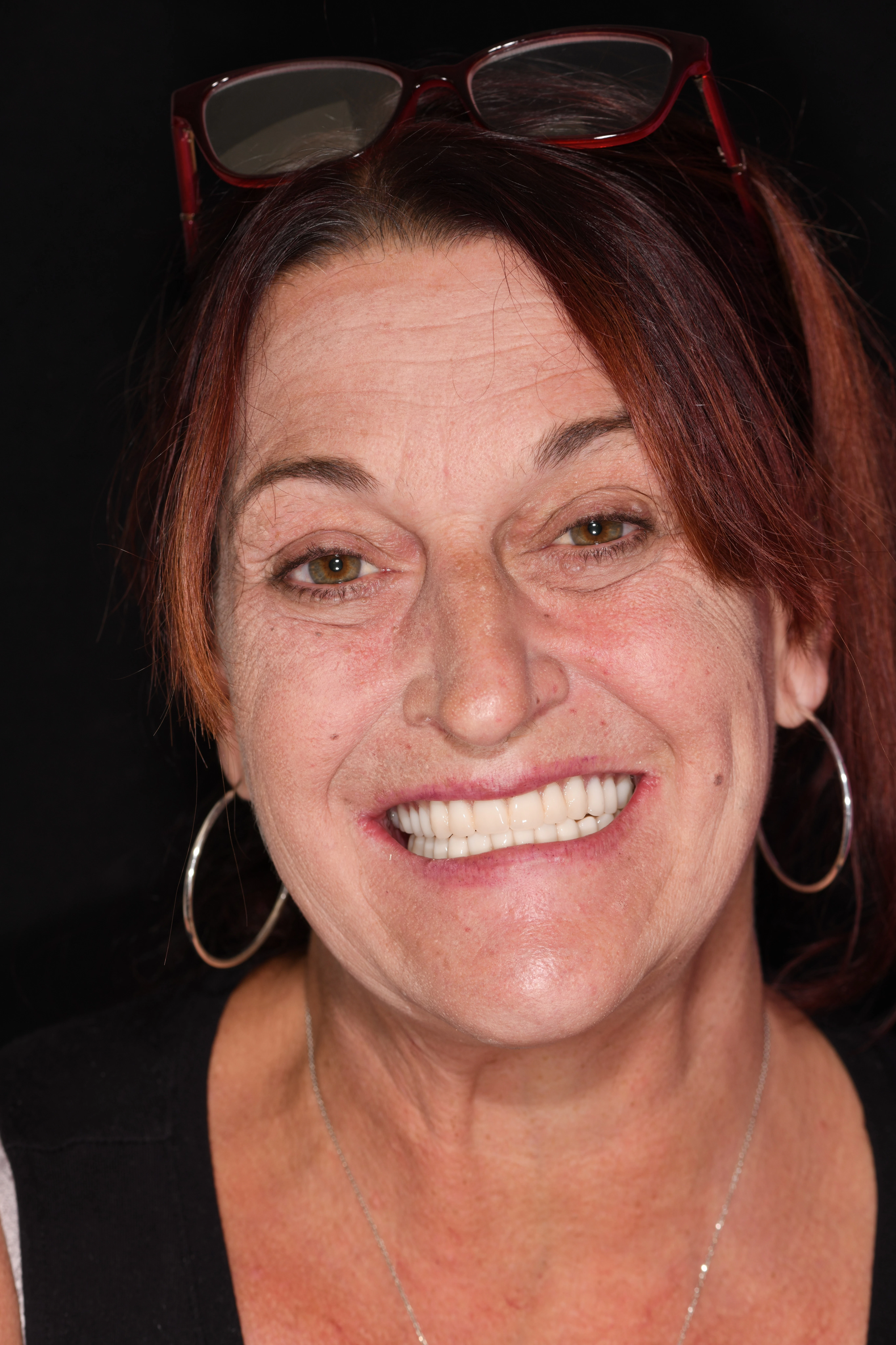 patient with dentures