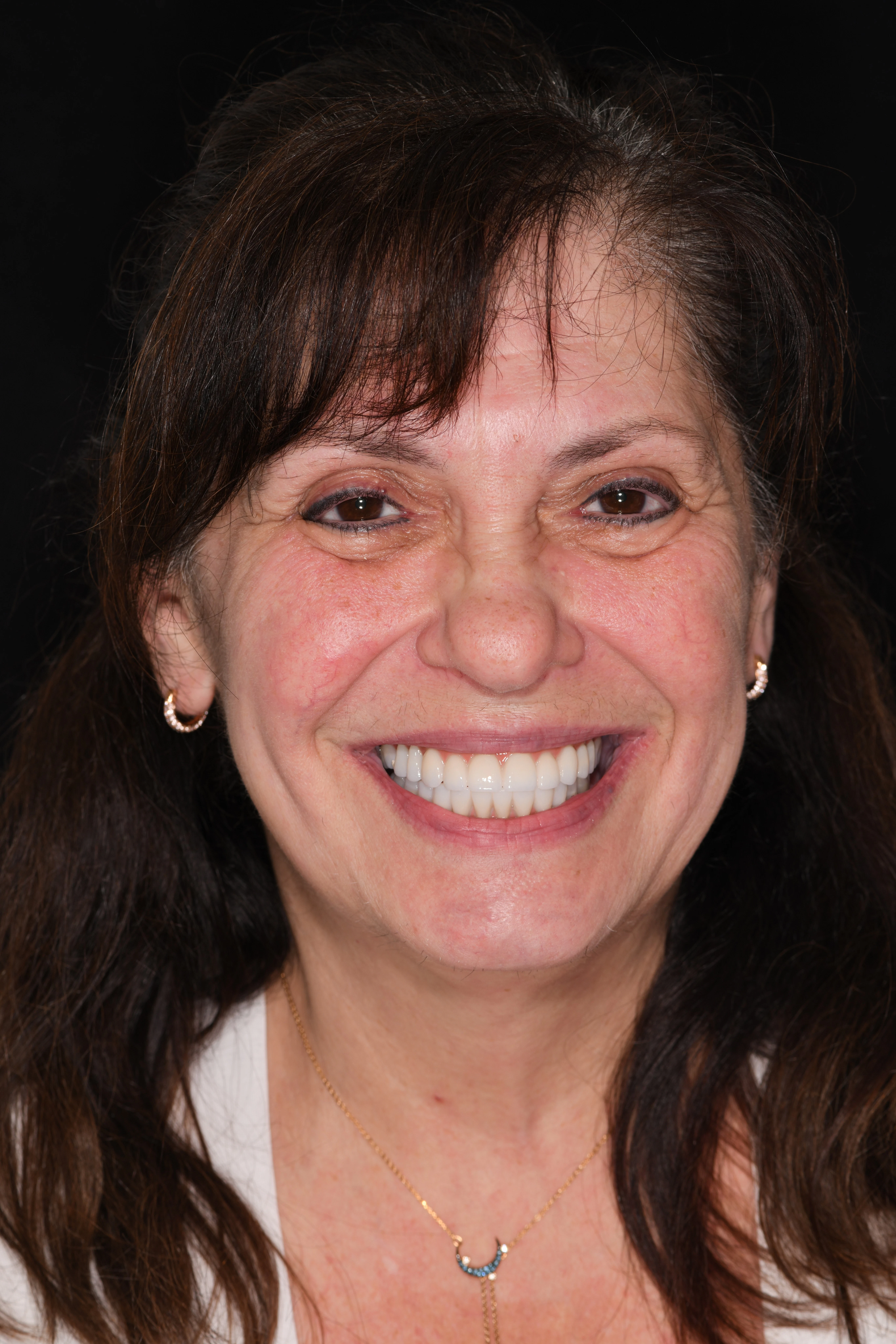 dental implants patient