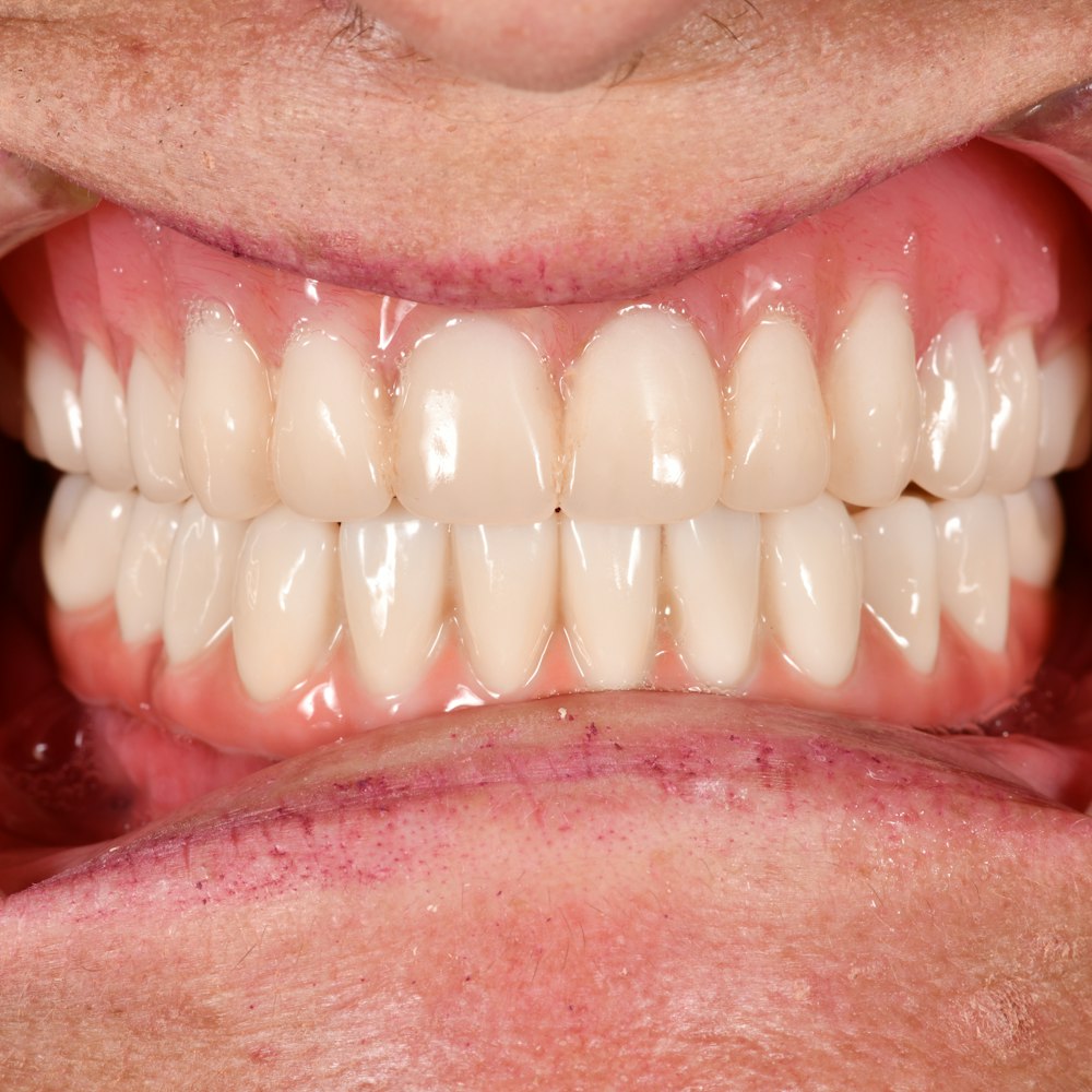 Nice teeth