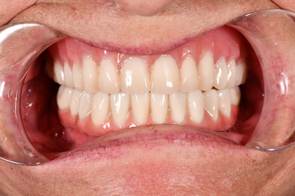 Nice teeth