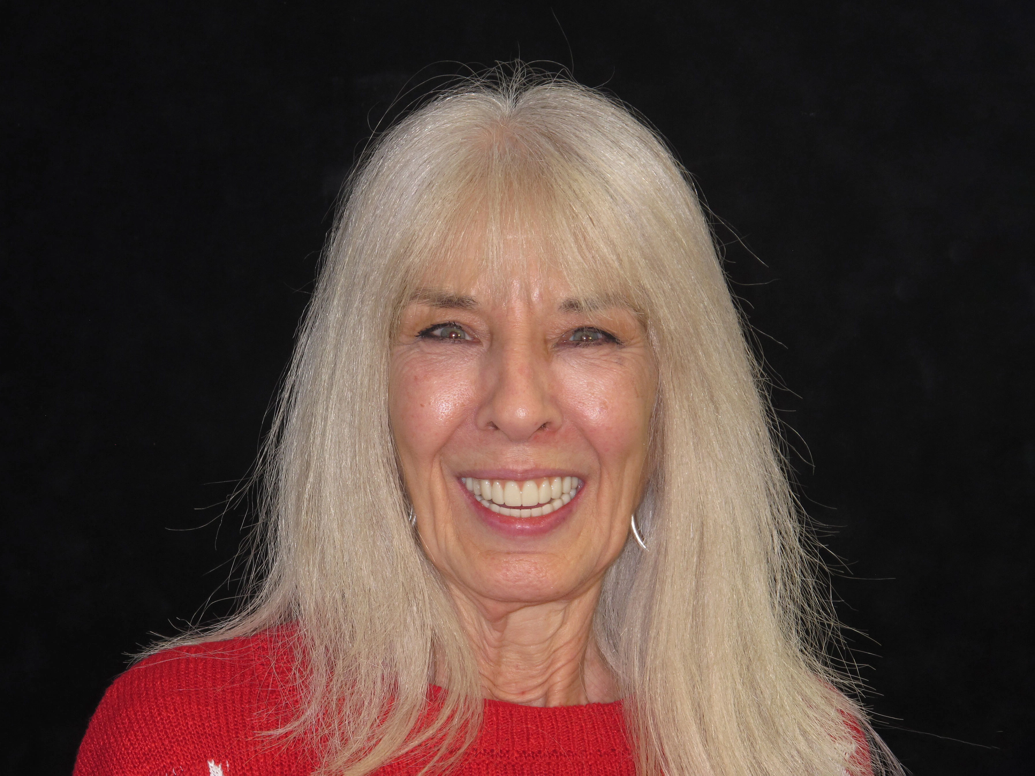 before and after dental implants