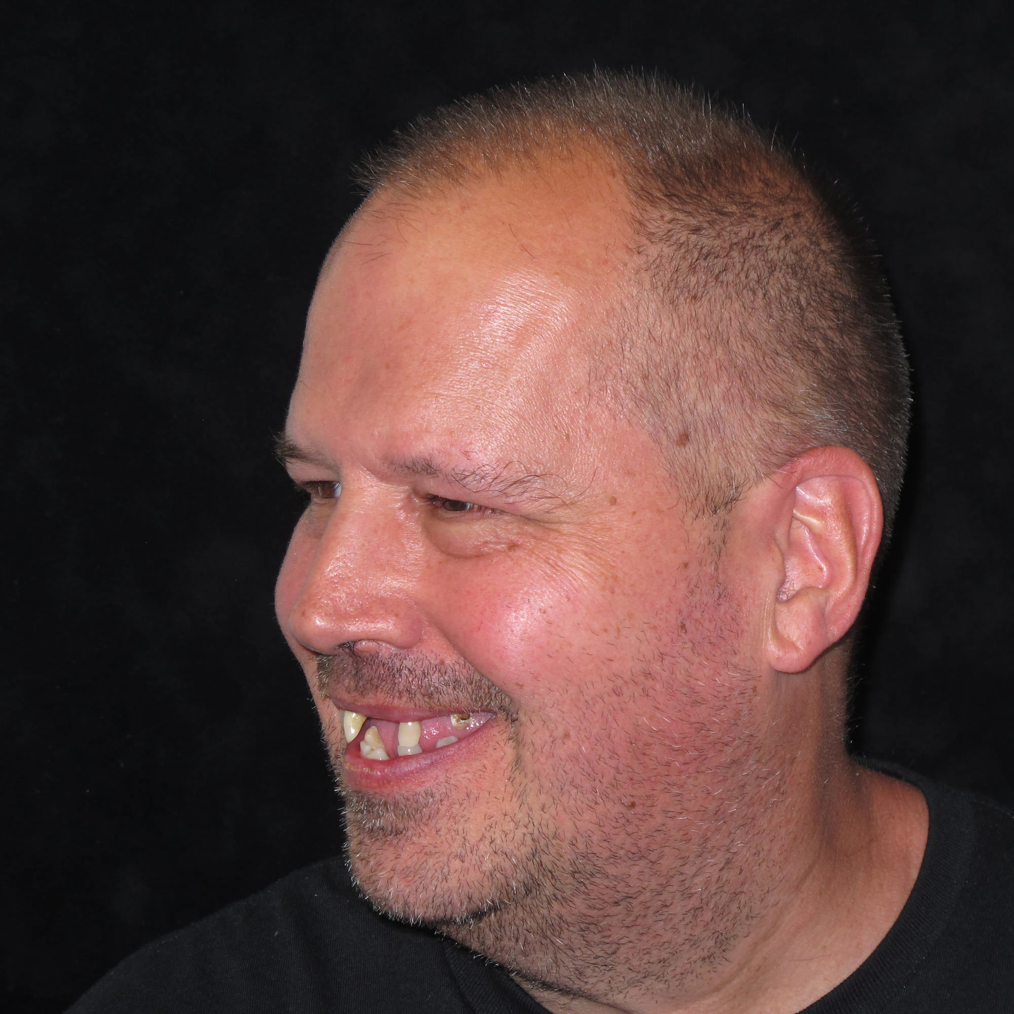 before restorative dentistry