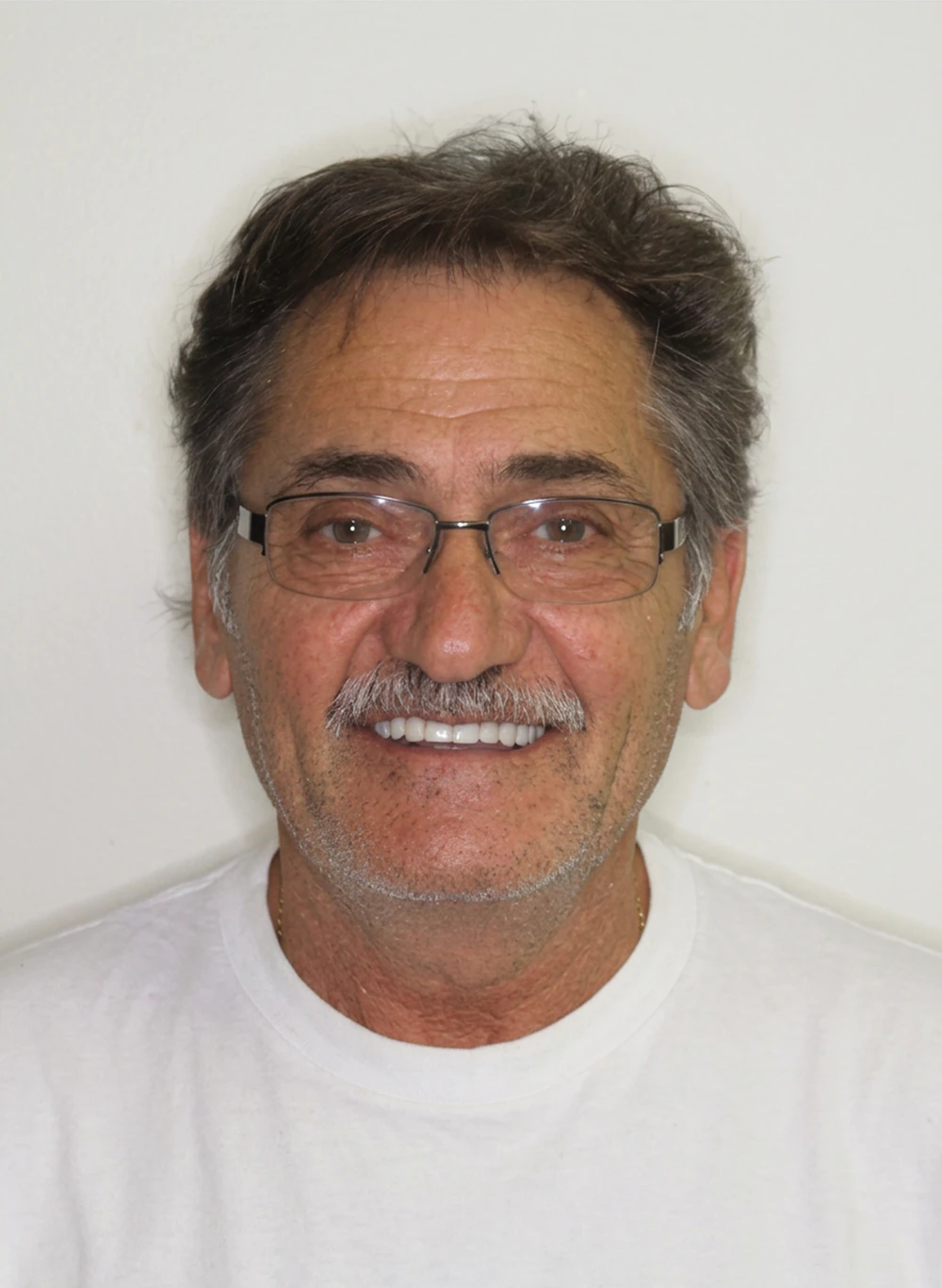 Denture patient
