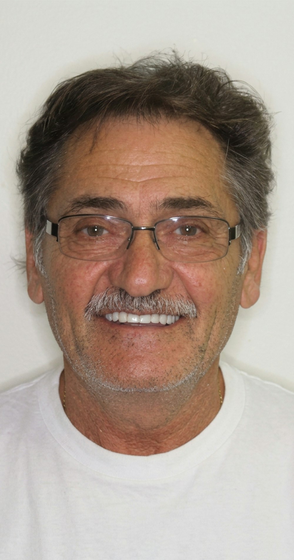 Denture patient