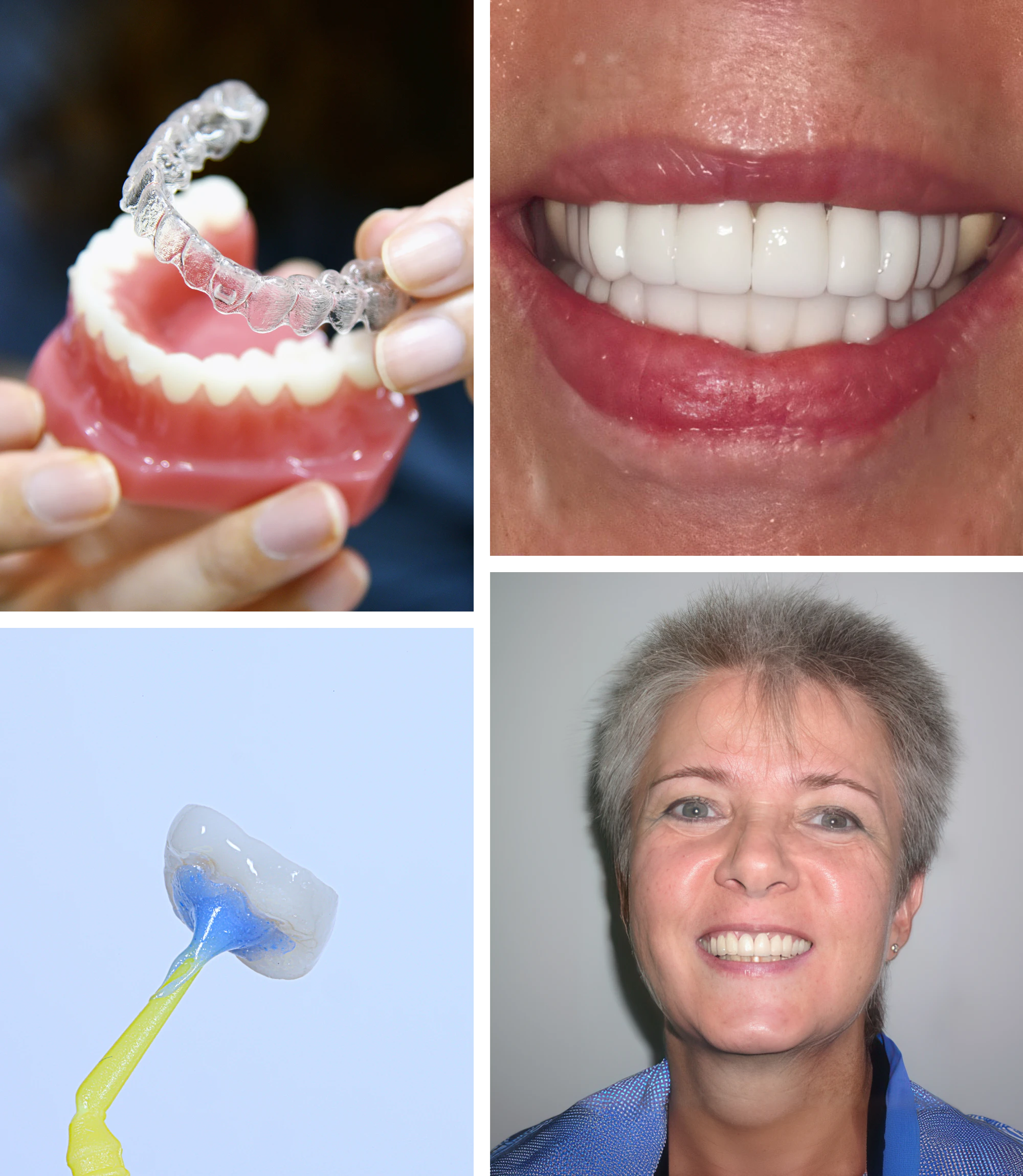 cosmetic dentistry treatments and results