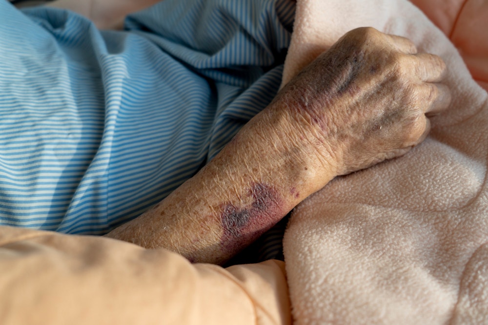 the hand of a senior
