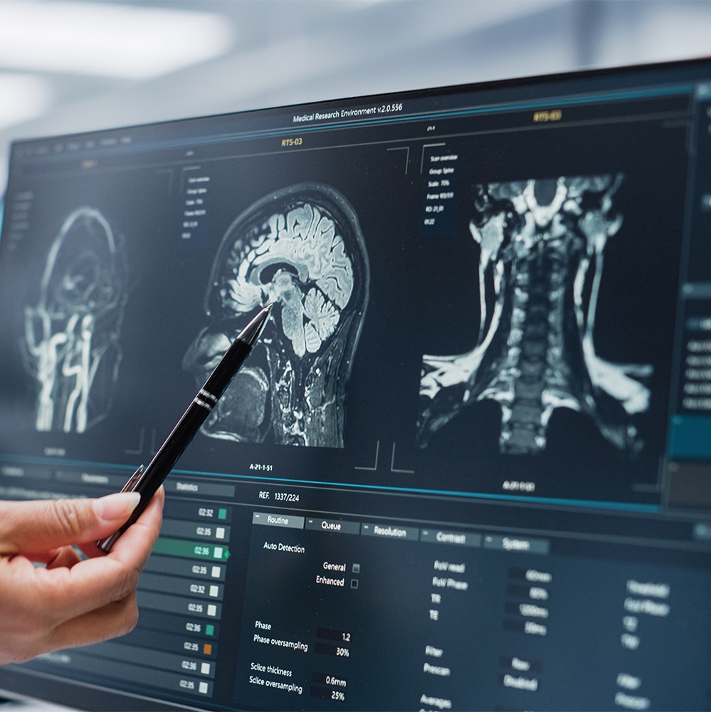 Doctor looking at a brain scan