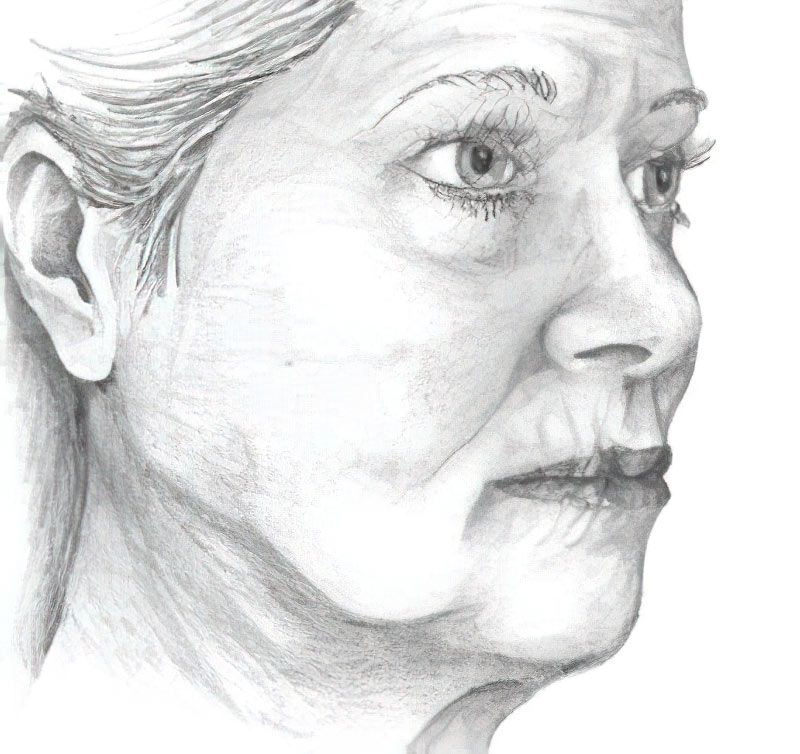 Illustration of face showing signs of aging