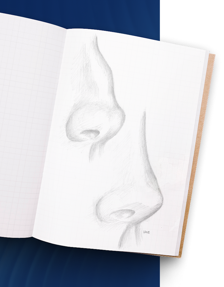 Dr. Hove's illustration of a patient's nose