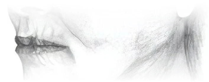 illustration of facial signs of aging