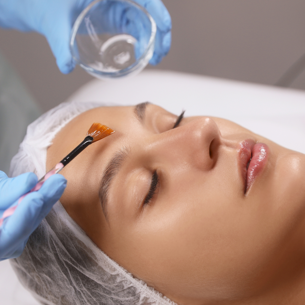 woman during chemical peel treatment