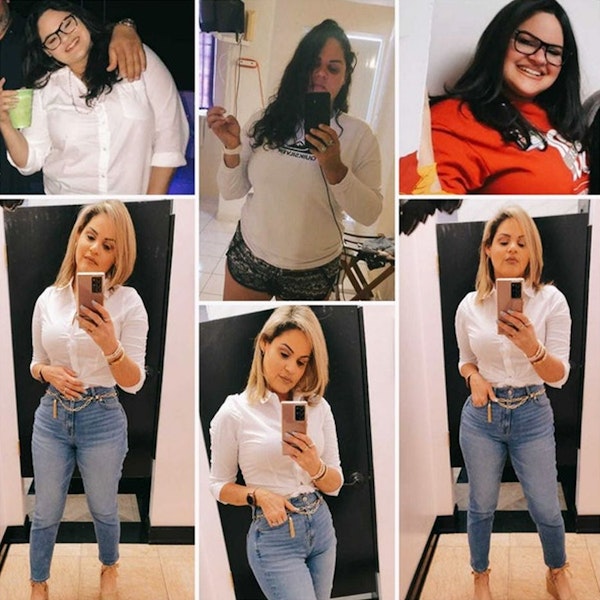 Picture collage of woman before and after gastric sleeve surgery