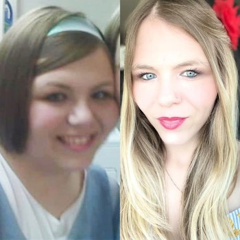 Patient before and after 1