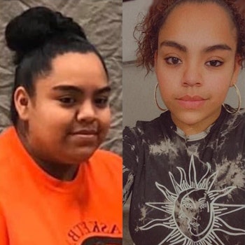 Patient before and after 2