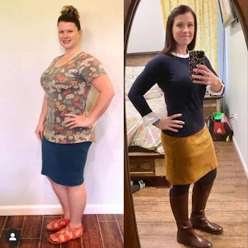 Patient before and after 3