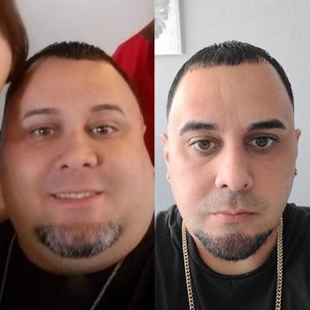 Patient before and after 4