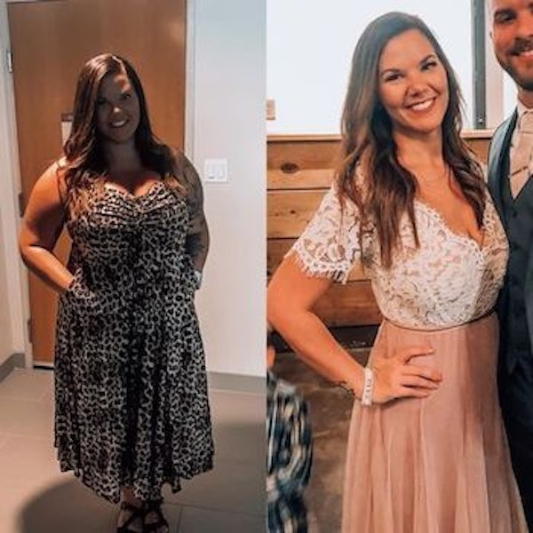 Young, brunette woman before and after gastric sleeve surgery