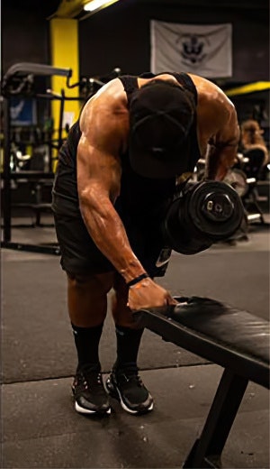 Anthony After Gastric Sleeve Surgery