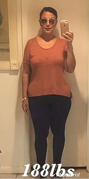 After Gastric Sleeve Surgery