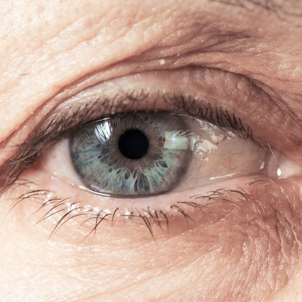 Close up of sagging eyelids