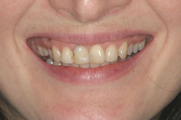 Before smile makeover