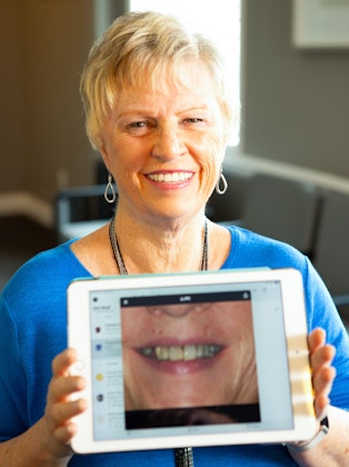woman with perfect smile holding a picture of her before smile