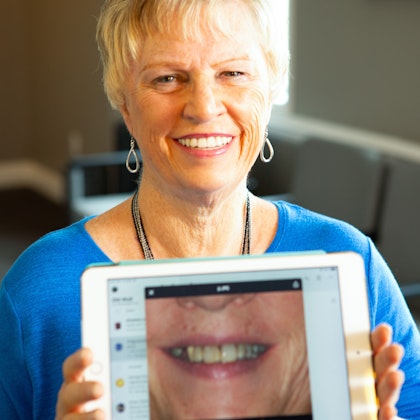 woman with perfect smile holding a picture of her before smile