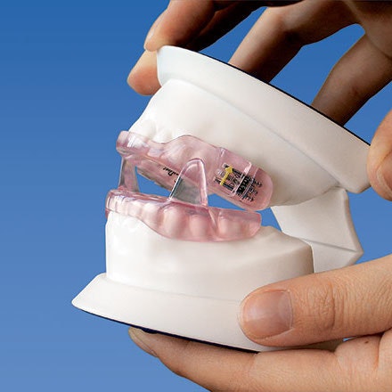 A brunette woman smiles after receiving sleep apnea treatment