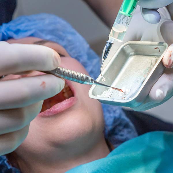 bone grafting procedure
